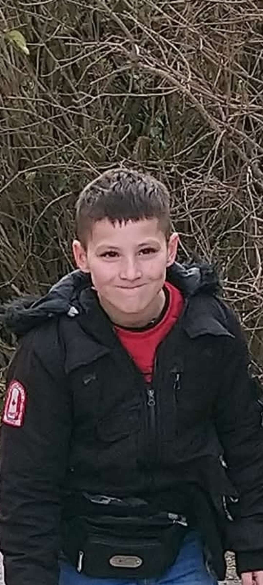 Mon avant (10 ans) Mon apr&egrave;s (16 ans)
