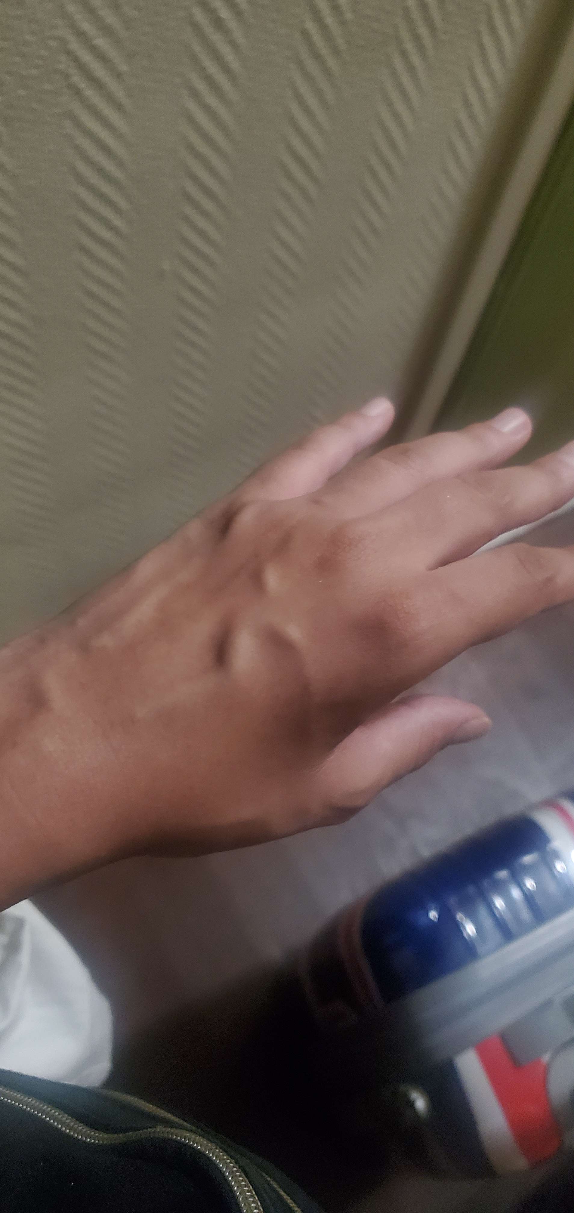 Y'a pas &agrave; avoir une main aussi veineuse