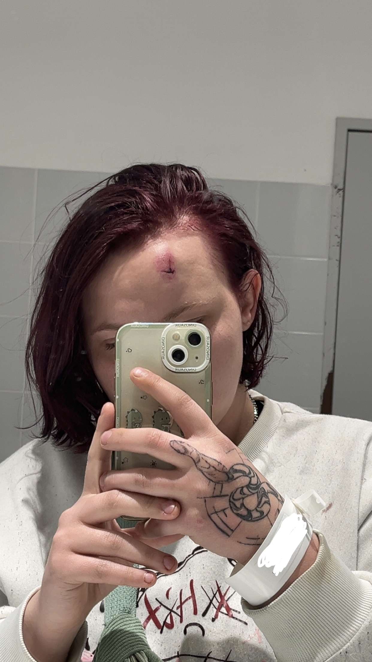 POV tu voulais boire un coup avec une pote tu finis &agrave; l&rsquo;h&ocirc;pital.