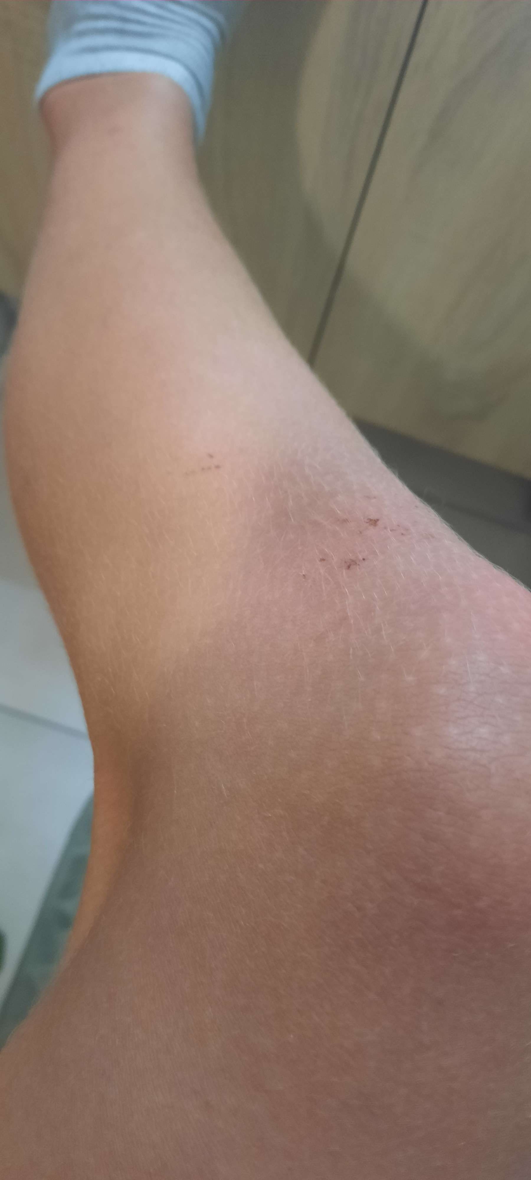 Ma jambe demande de l'aide face au terrain s'intetique apr&egrave;s des arr&ecirc;t miraculeux qui on fait sauver ma petite &eacute;quipe de 4 face &agrave; 7